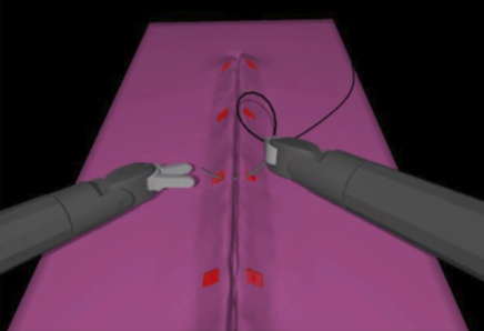 Suturing